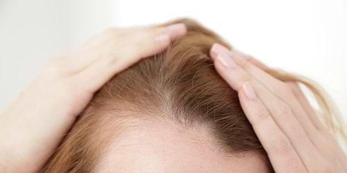 thin hair