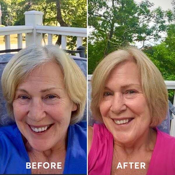 CapriBlonde_BeforeandAfter