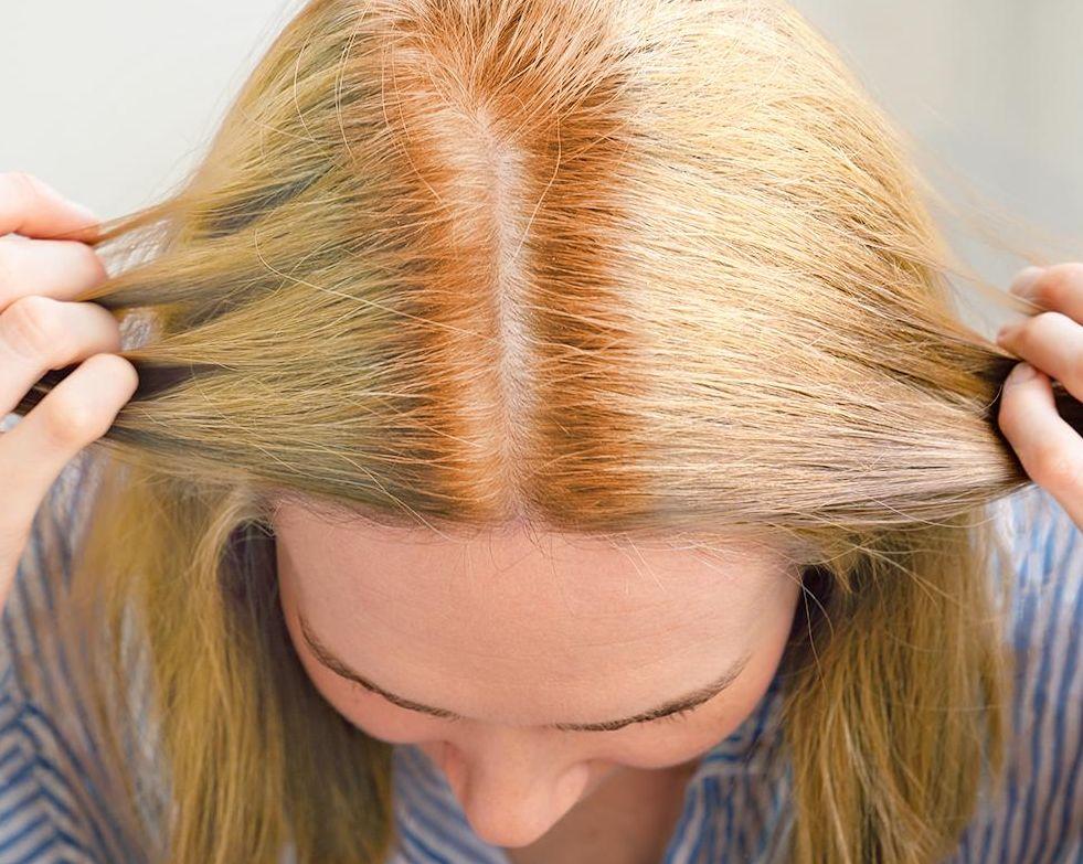 hot roots on hair