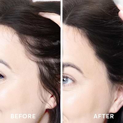 fill in thinning hairline with root touch up powder