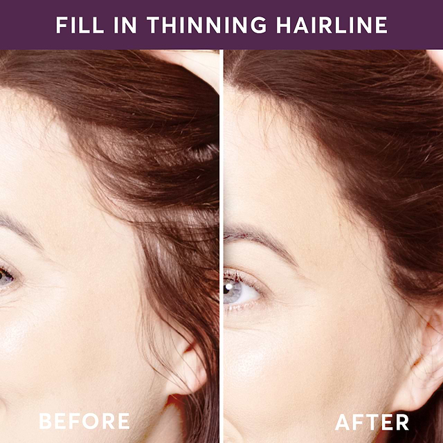 TGCU-Sienna-BA-Hairline-2000 (1)