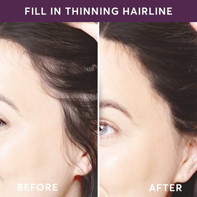 TGCU-Ombra-BA-Hairline-2000