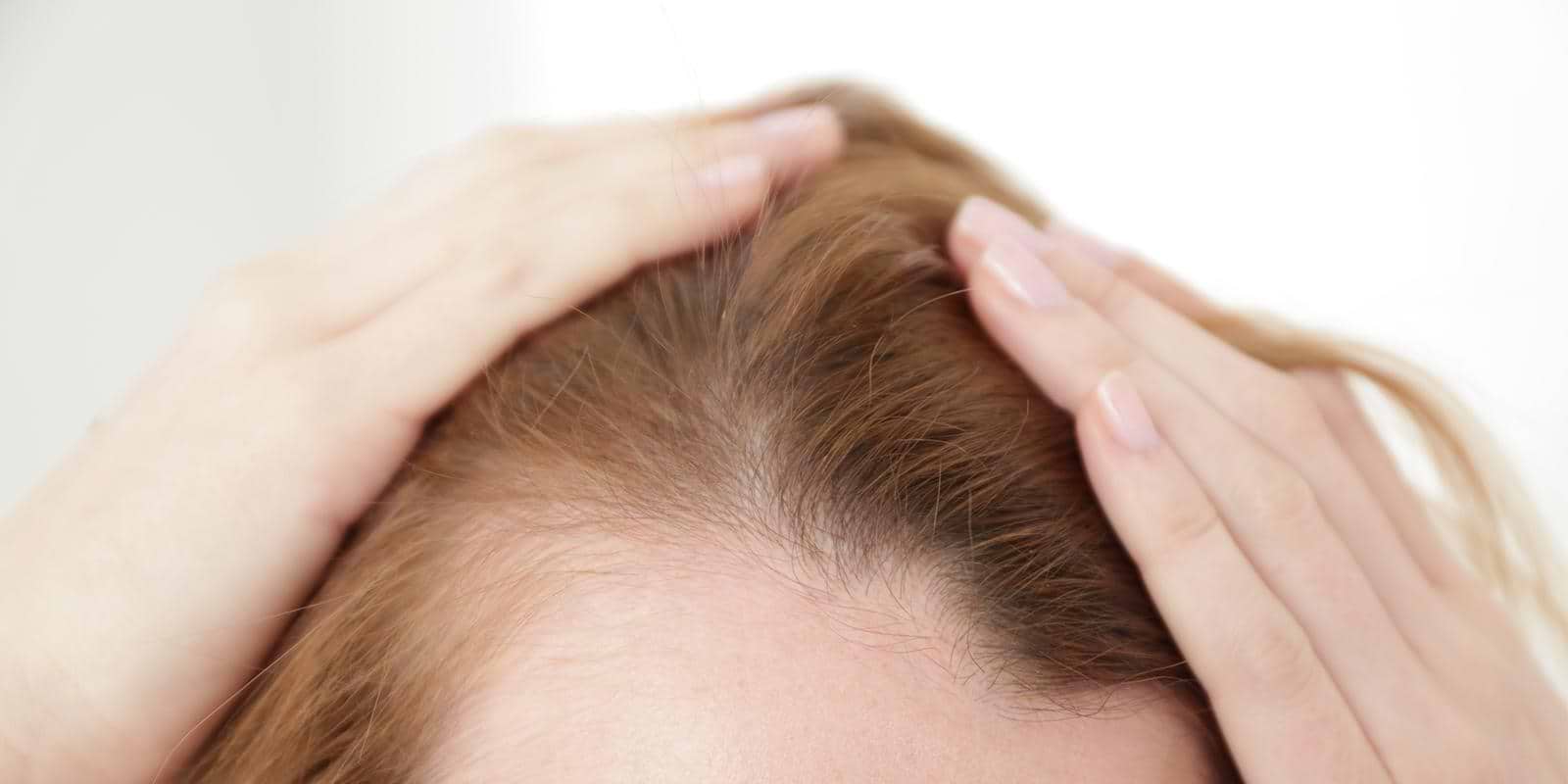 thin hair